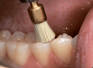 Полир для композитов P1500